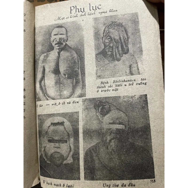 Các bệnh ngoại khoa - N.N. ÊLANXKI hơn 700 trang , dịch từ nước ngoài  799772