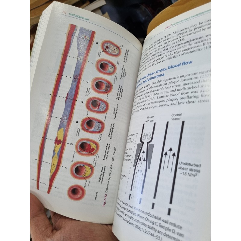 ESSENTIAL HYPERTENSION (2013) - John M. Cruickshank 138250