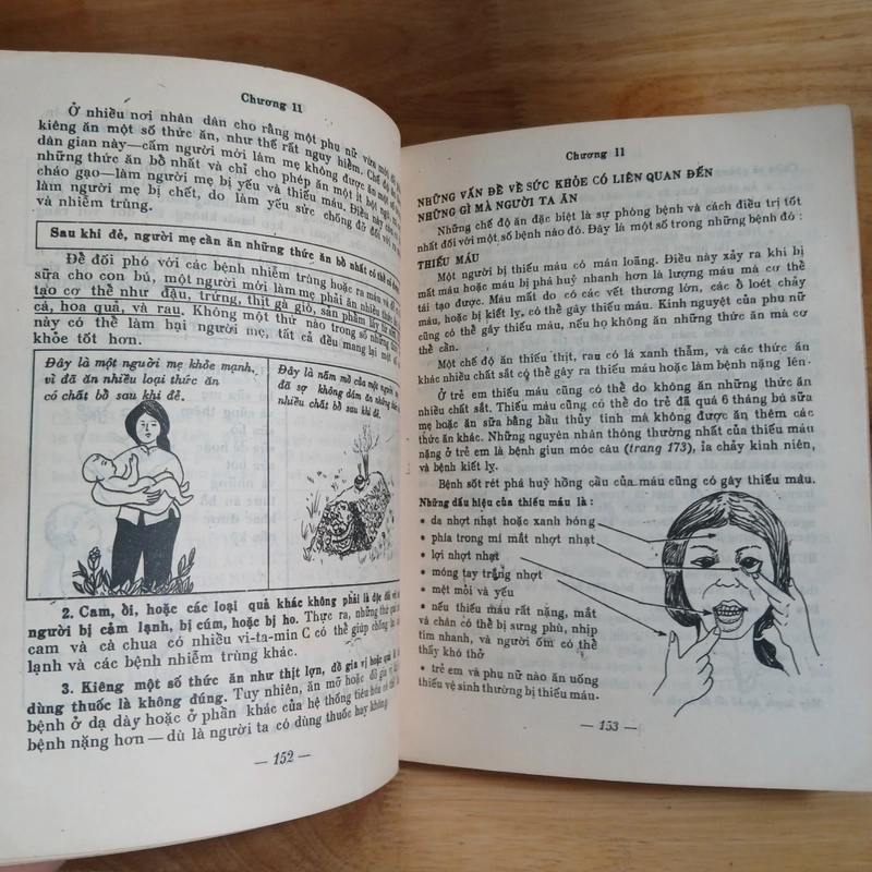 Chăm Sóc Sức Khỏe (Xb 1987) - David Werner 552957