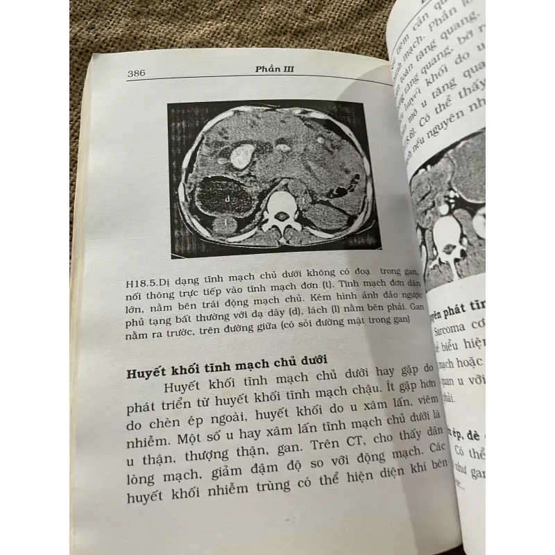 Sách y - CT BỤNG VÀ CHẬU - 450 trang  791924