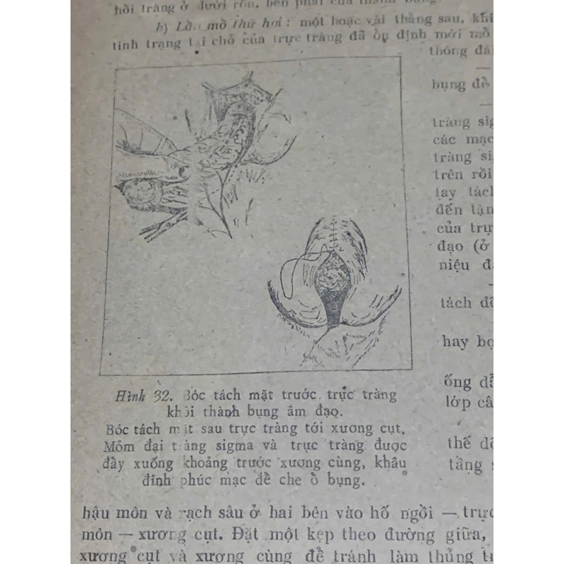 PHẪU THUẬT ỐNG TIẾU HOÁ - sách y học, Tây Y , khổ lớn  539876