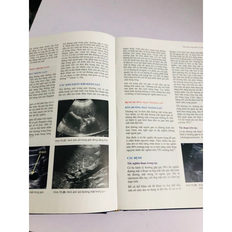 📚 SỎI ĐƯỜNG MẬT – Nguyễn Đình Hối, Nguyễn Mậu Anh 539457