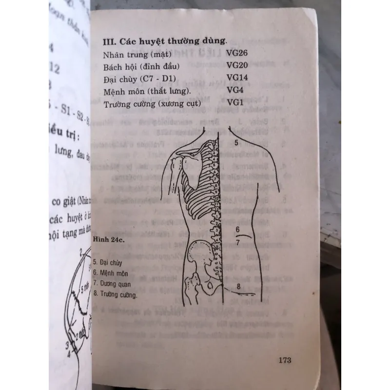 Châm cứu trị di chứng viêm não - Bác sĩ Nguyễn Thị Trương  1027837