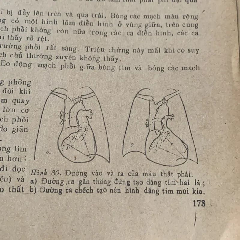 Chuẩn đoán X quang lâm sàng, Đặng Văn Ấn 608559