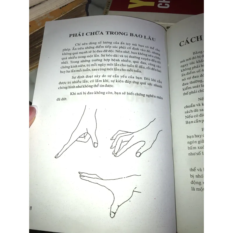 Bấm huyệt (Cách chữa & sự ích lợi) - FM. Houston, DC 1001145