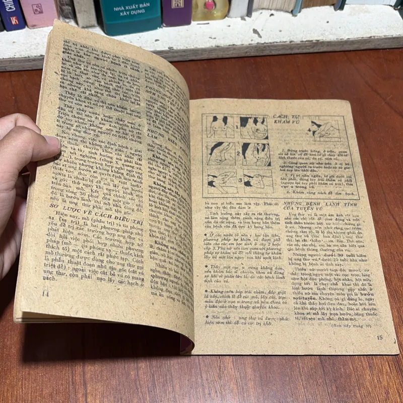 II Phụ Bản Khoa Học Phổ Thông: Triệu Chứng Phòng Ngừa Chữa Trị Bệnh Ung Thư 960400