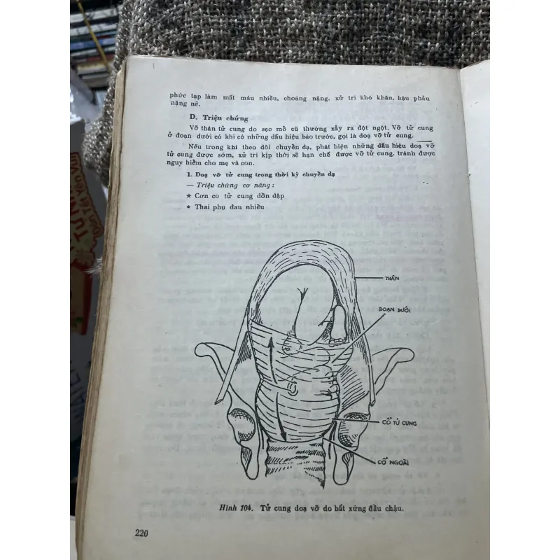 Bài giảng sản phụ khoa 2 tập - 1990, sách khổ lớn; khoảng 700 trang  1006351