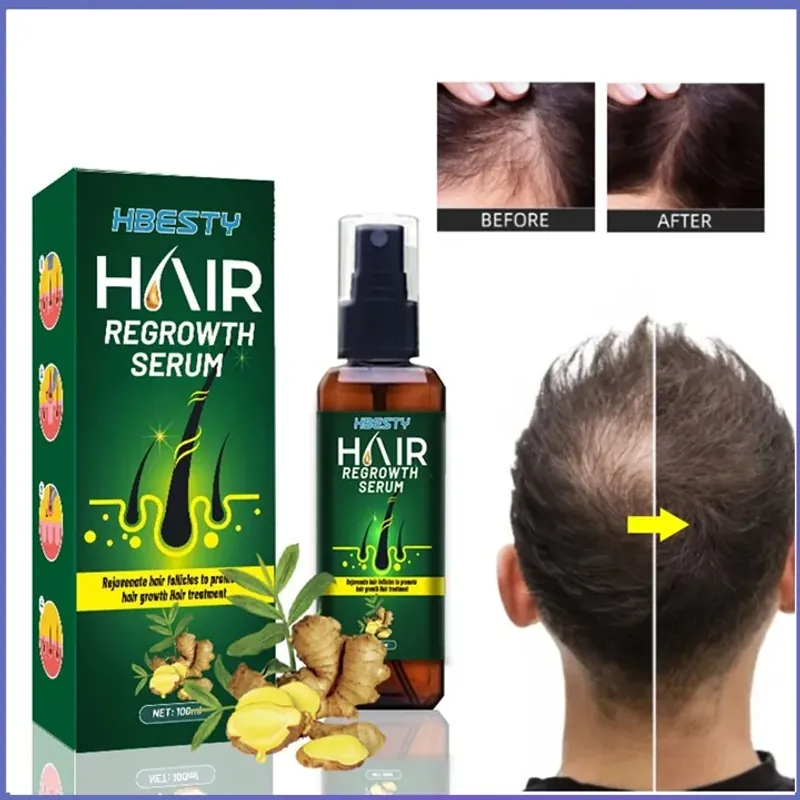 Serum dưỡng mọc tóc, giúp tóc mọc nhanh, nhiều và dày, sợi tóc đen bóng 800860