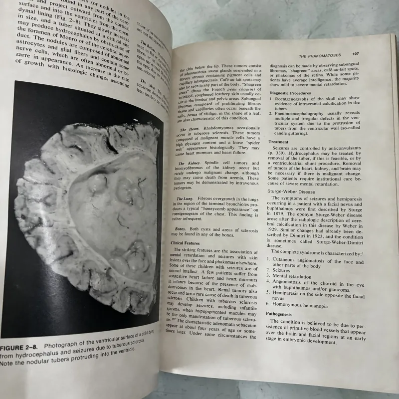 Medical Neurology 1041226