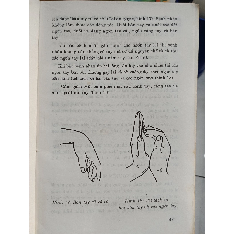 Bệnh học thần kinh - Hồ Hữu Lương 795925