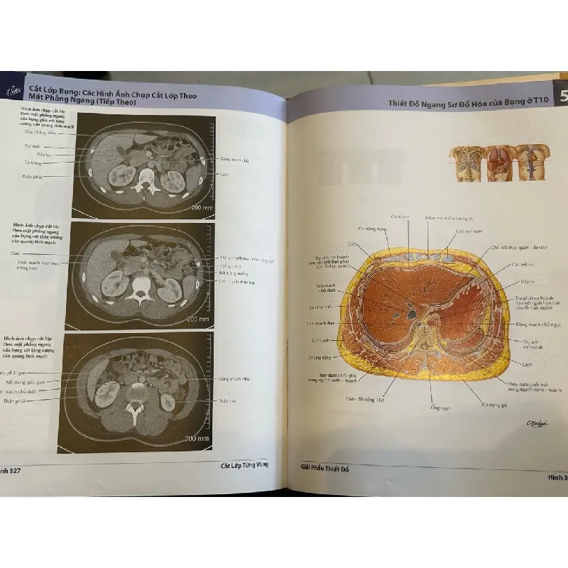 Atlas giải phẫu người - Frank H.Netter,MD 656444