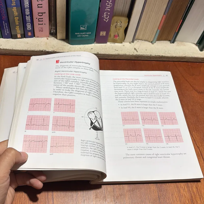 II Sách Y Học (Tiếng Anh): The Only EKG Book _ You’ll Ever Need - Malcolm S. Thaler 934720