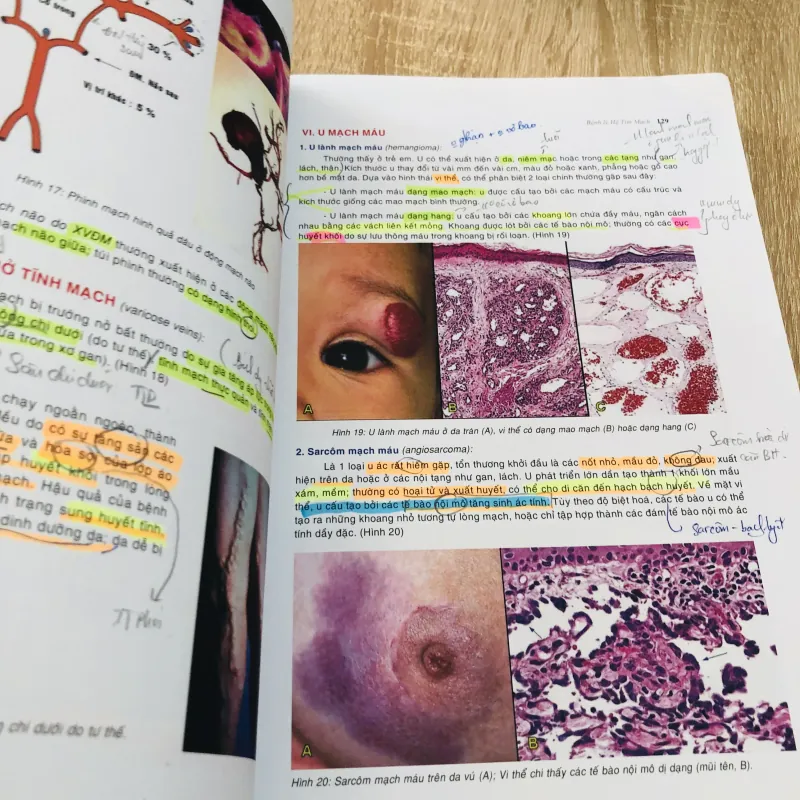 BÀI GIẢNG LÝ THUYẾT GIẢI PHẪU BỆNH  1004278