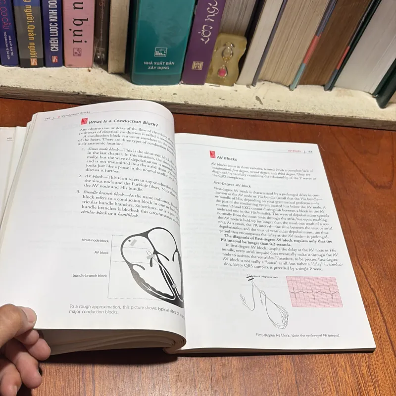 II Sách Y Học (Tiếng Anh): The Only EKG Book _ You’ll Ever Need - Malcolm S. Thaler 934720