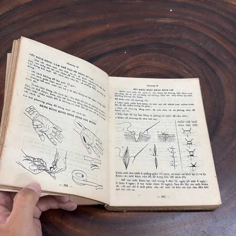 II Sức Khoẻ: Chăm Sóc Sức Khoẻ - DAVID WERNER - 1983 1010438