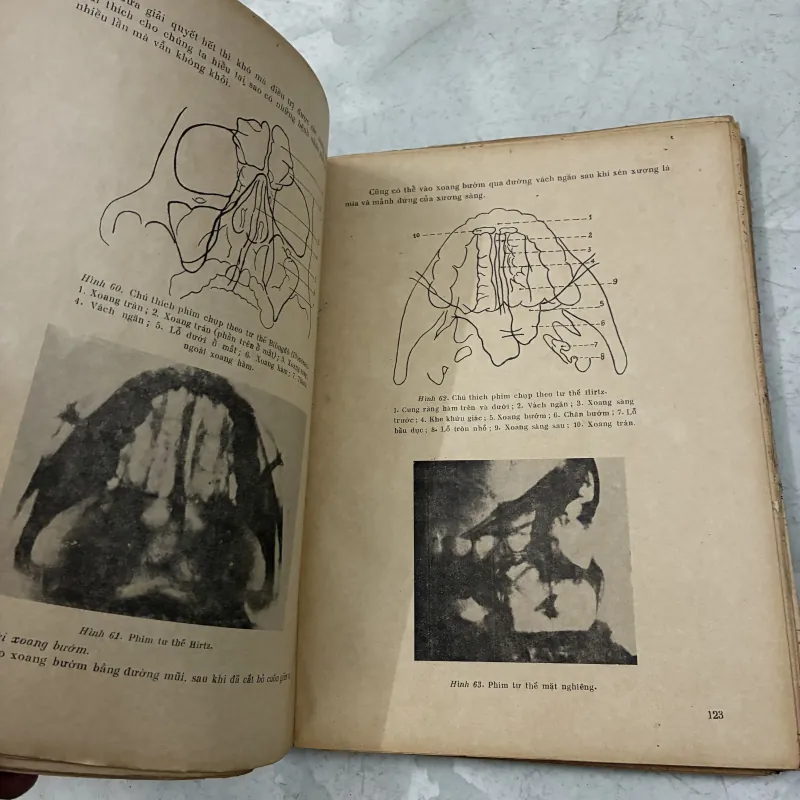 Tai mũi họng thực hành (Tập 1) - Võ Tấn - 1974s 1013087