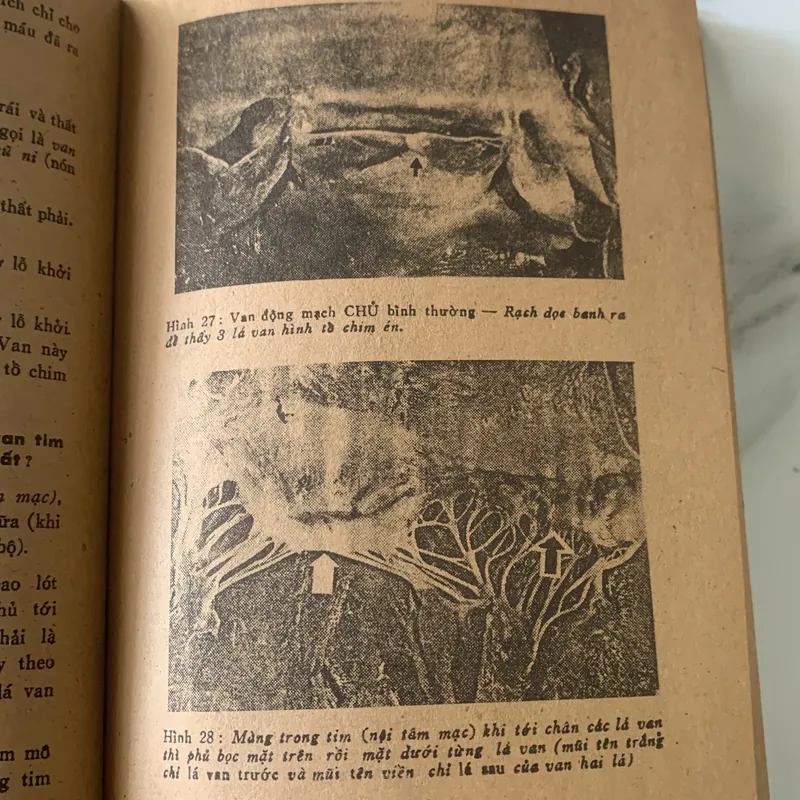 Phòng ngừa và tự điều trị bệnh tim mạch, Giáo sư Nguyễn Huy Dung, in năm 1988 709431