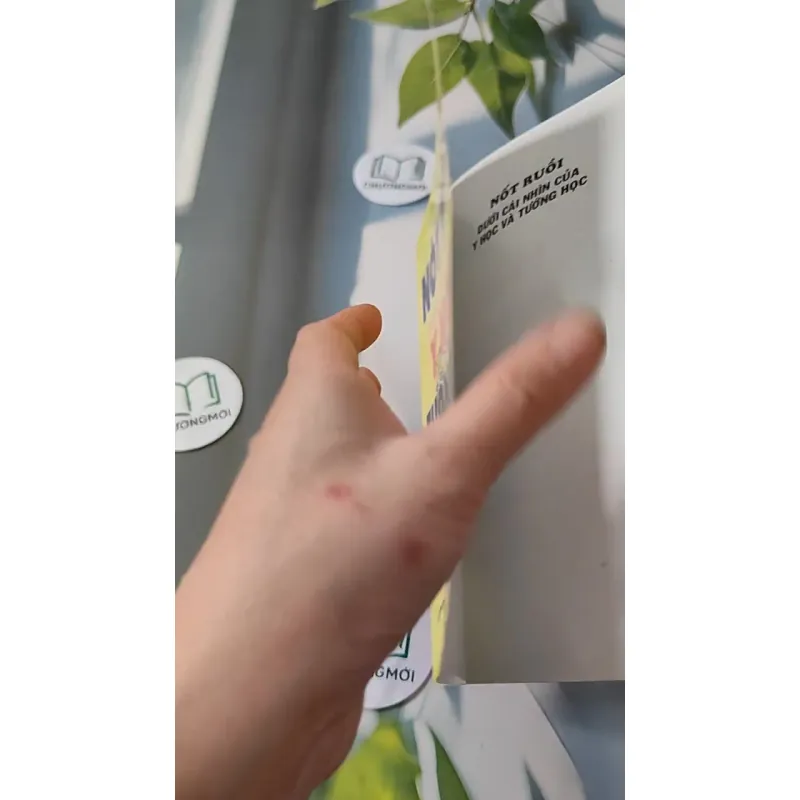 Nốt Ruồi Dưới Cái Nhìn Y Học & Tướng Học - Như Hùng 727280