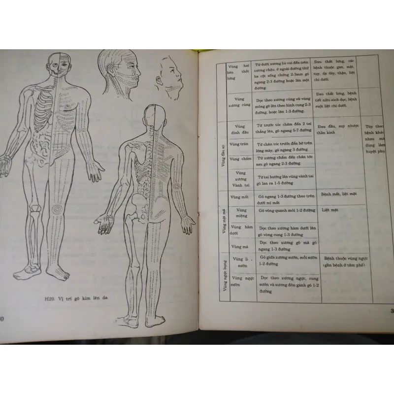 CHÂM CỨU KẾT HỢP CỔ TRUYỀN VỚI HIỆN ĐẠI - LÊ QUÝ NGƯU 588887