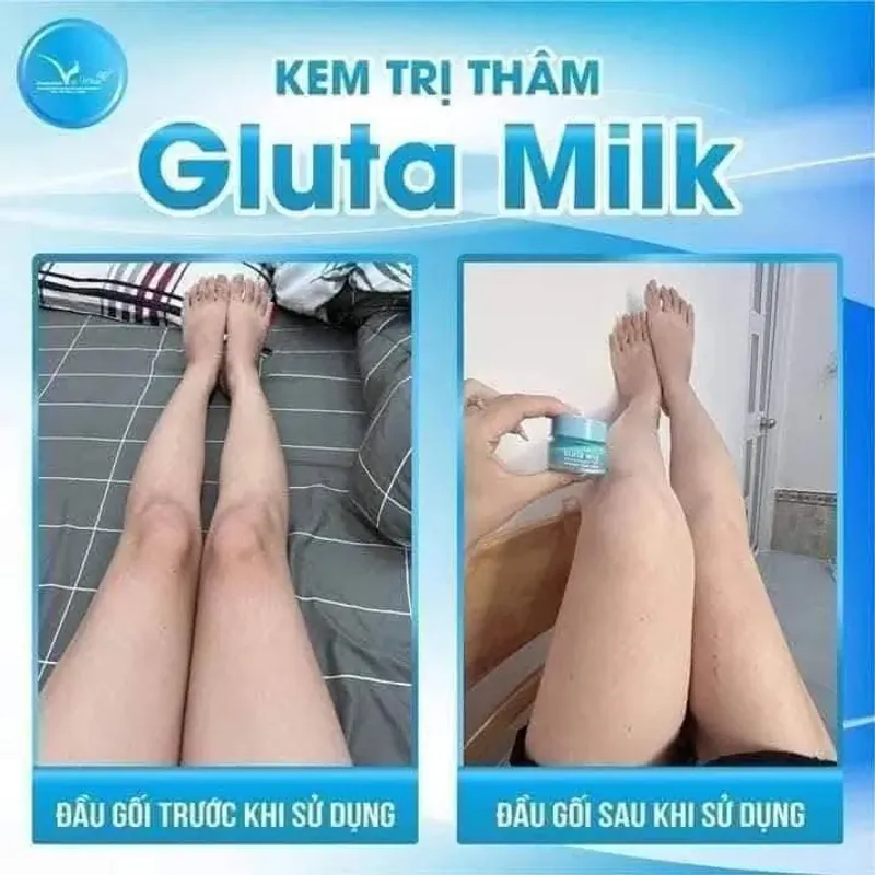 Kem trị thâm nách, bẹn.... 971564