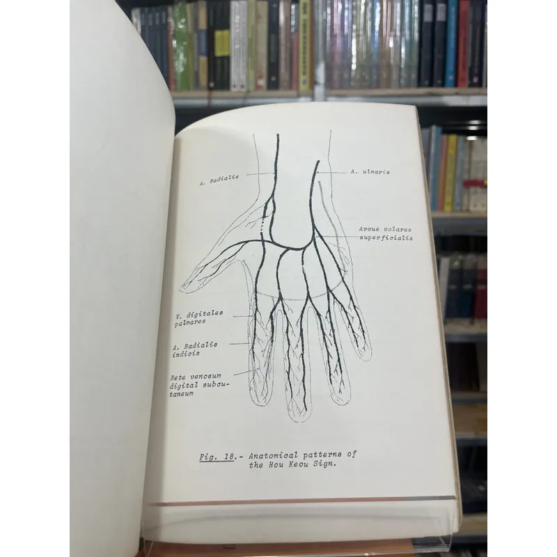 HOU KEOU, A PROGNOSTIC SIGN IN CHILDREN - PHAN TIÊN THÁI 590862