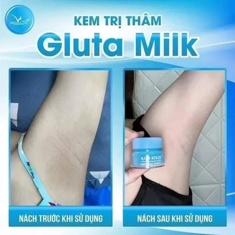 Kem trị thâm nách, bẹn.... 971564