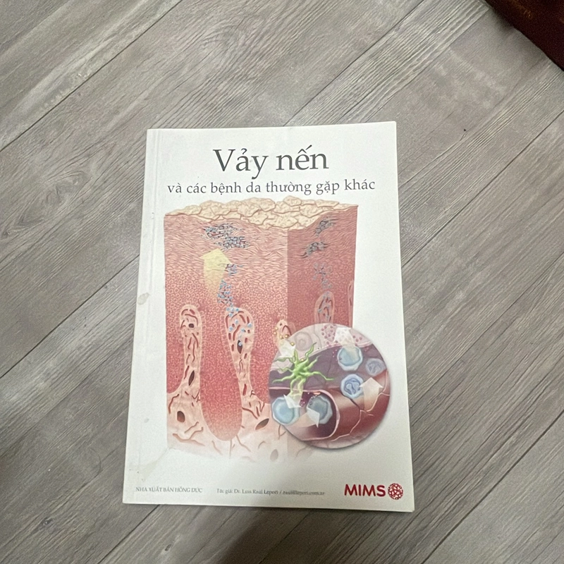 Vẩy nến các bệnh thường gặp  322541