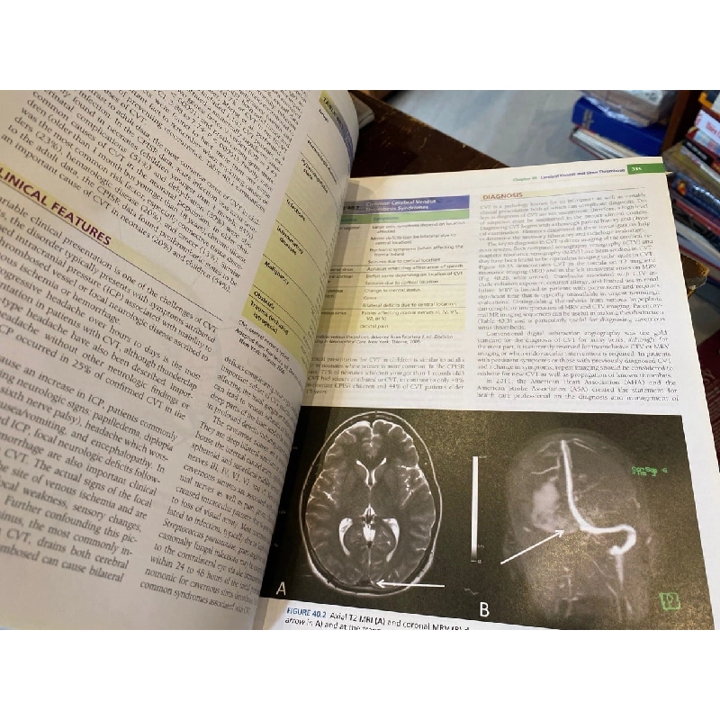Merritt’s Neurology, 13 edition 760547