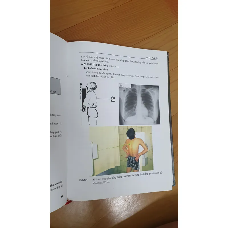 KỸ THUẬT CHỤP X QUANG 738448