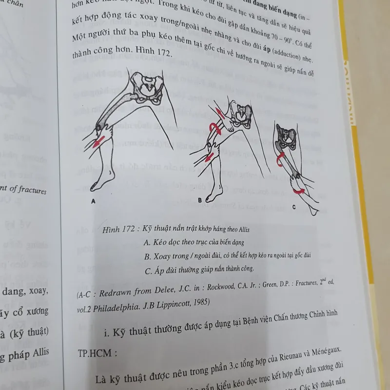 CHAN THƯƠNG HỌC VÙNG HÁNG  1024134