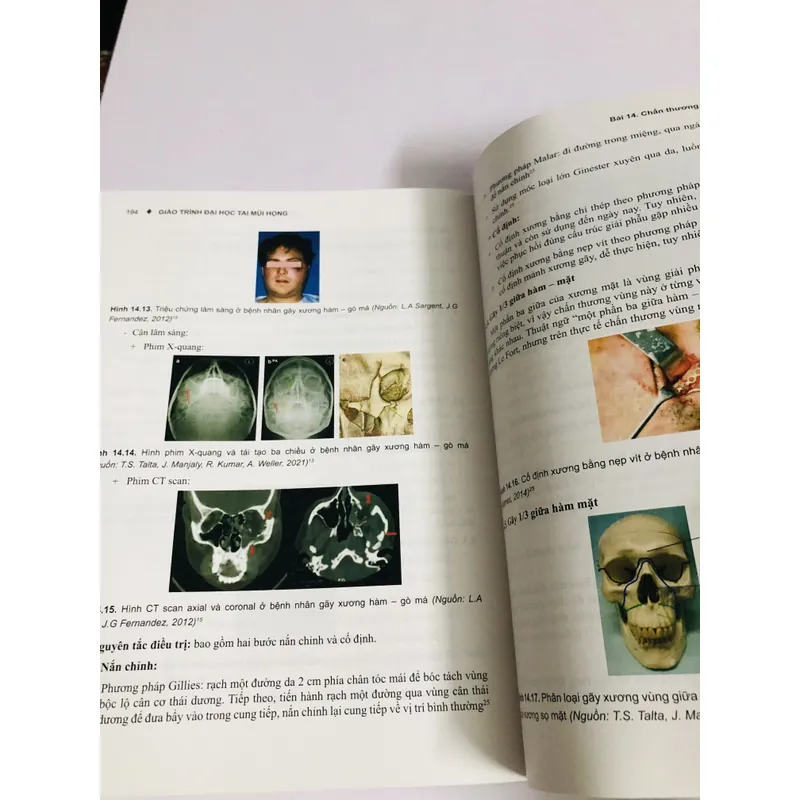 GIÁO TRÌNH ĐẠI HỌC TAI MŨI HỌNG  726490