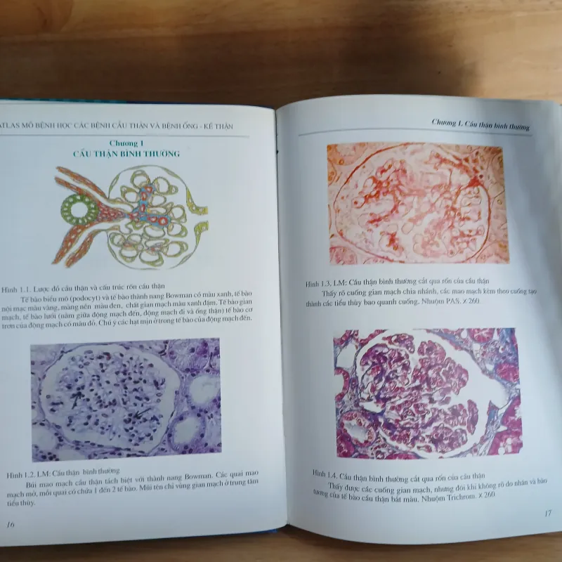 Atlast Mô Bệnh Học Các Bệnh Cầu Thận & Bệnh Ống - Kẽ Thận 799329