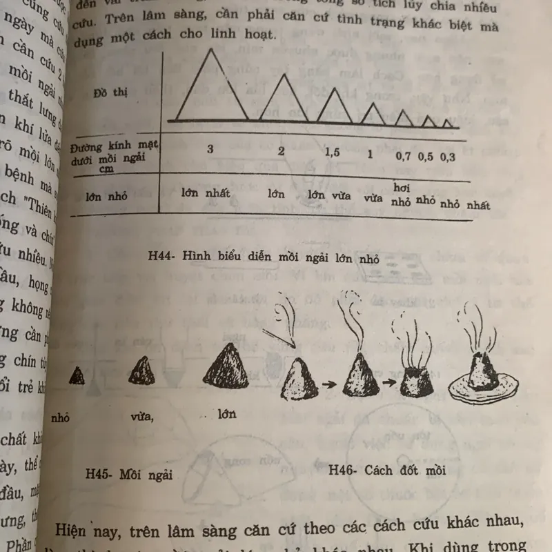 Châm cứu kết hợp cổ truyền với hiện đại, Lê Quý Ngưu 709492