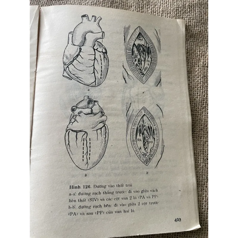 Bênh học tim mạch - hơn 400 trang -R.RULLIÈRE Giáo sư trường Đại học Paris VI 795820