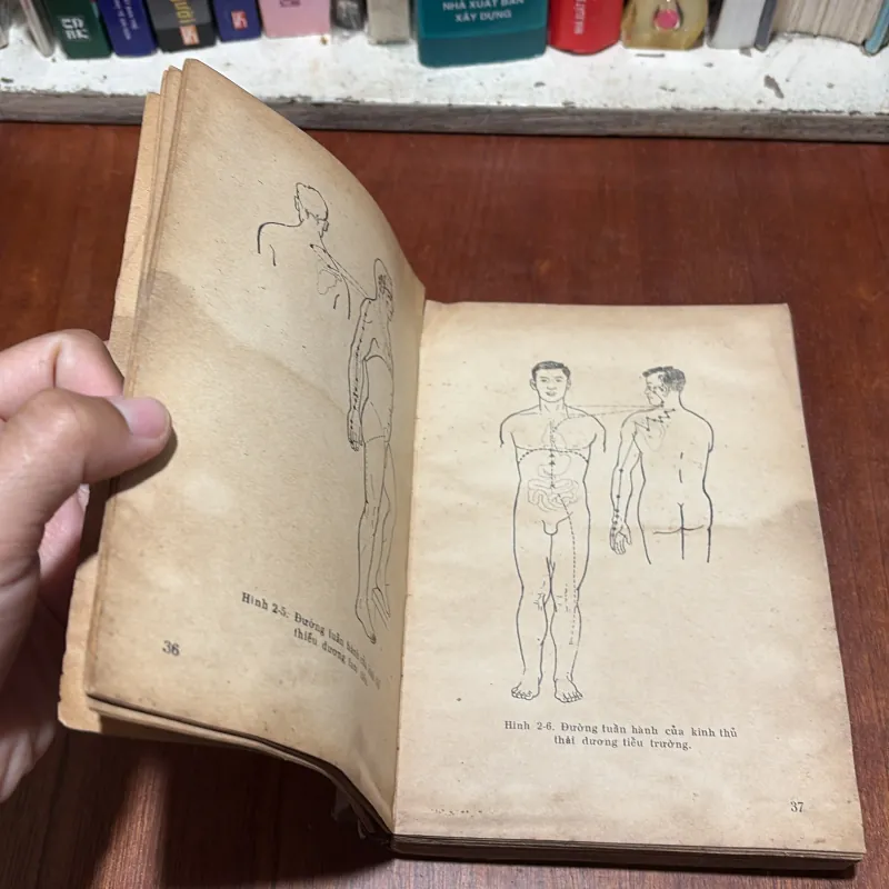 [Sách Mất Bìa, Tửng Bị Ẩm] - II Châm Cứu: Châm Tê - Hoàng Bảo Châu (Dịch) - 1975 798969