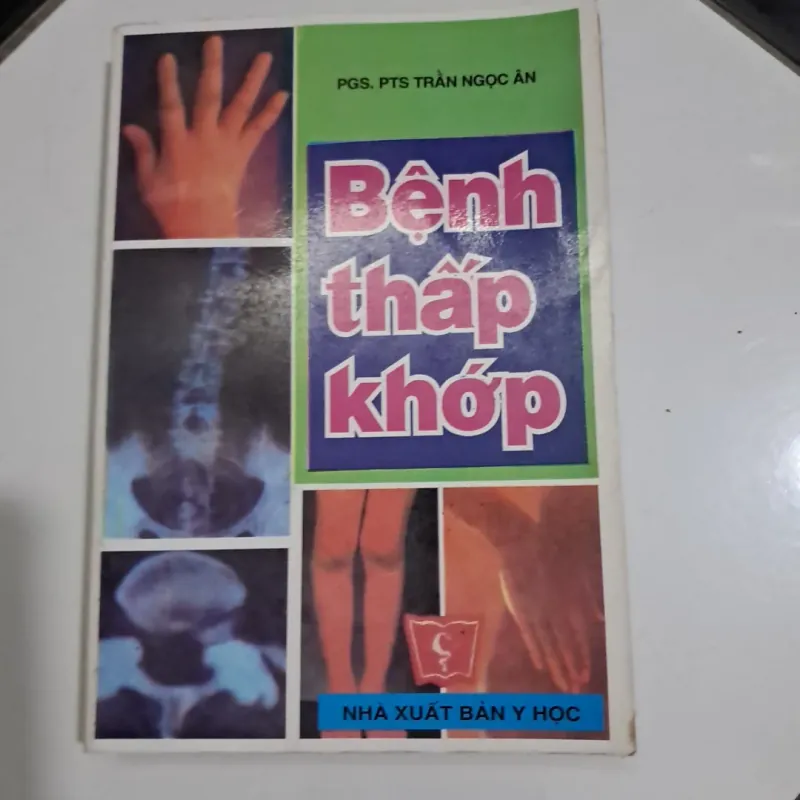 Bệnh thấp khớp 995572