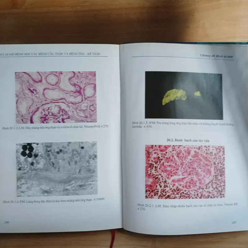 Atlast Mô Bệnh Học Các Bệnh Cầu Thận & Bệnh Ống - Kẽ Thận 799329