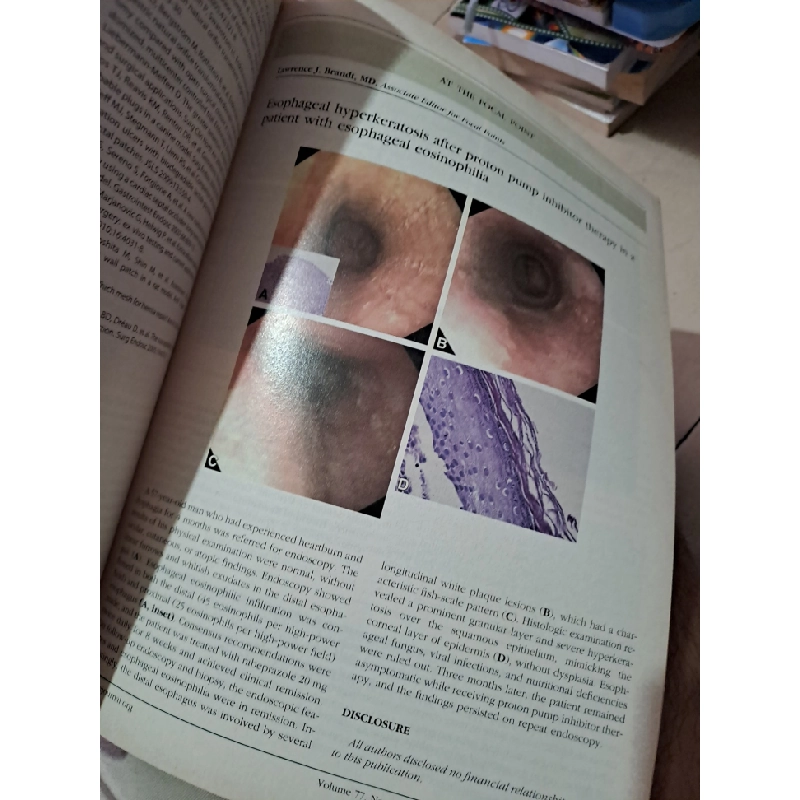GIE Gastrointestinal Endoscopy volume 77 no 1 1/2013 HCM0808 TẠP CHÍ, THIẾT KẾ, THỜI TRANG 527277