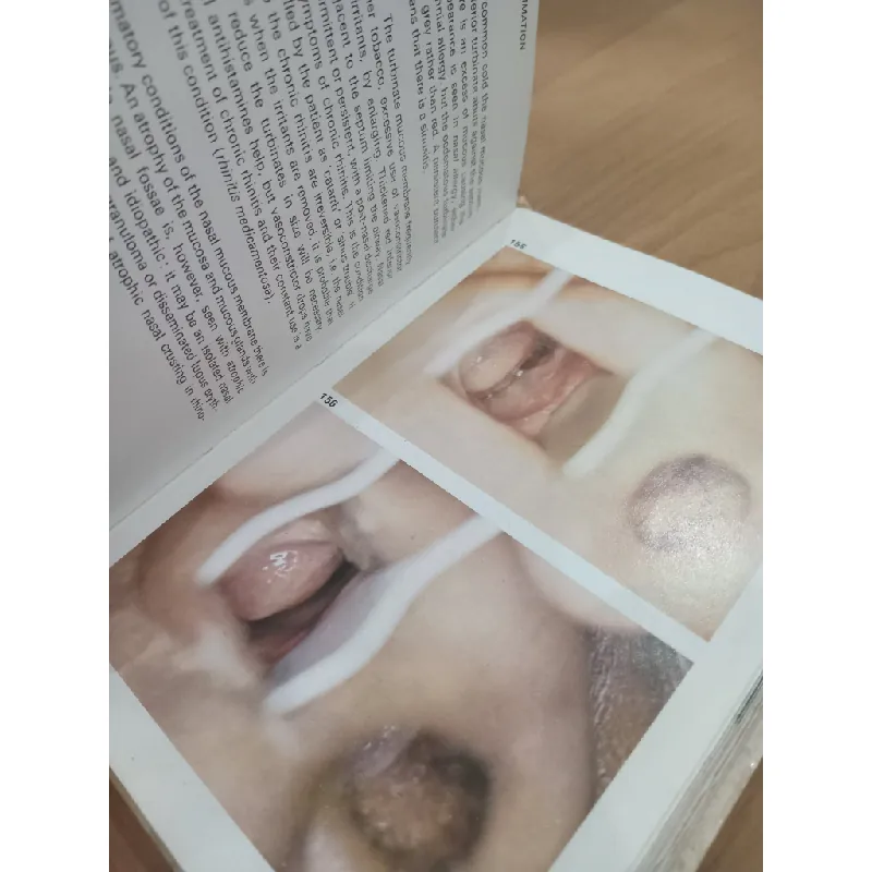 A colour atlas of E. N. T. Diagnosis - T. R. Bull 553141
