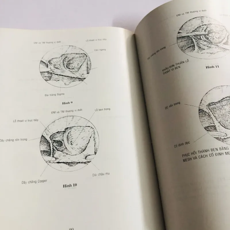 TÀI LIỆU HƯỚNG DẪN PHẪU THUẬT NỘI SOI 780444