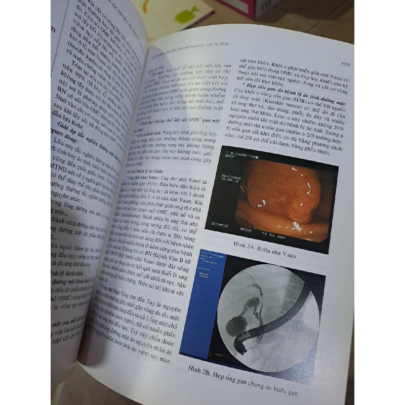 Tạp chí khoa học tiêu hóa việt nam tập VII số 29 mới 90% 2012 HCM0808 TẠP CHÍ, THIẾT KẾ, THỜI TRANG 923605