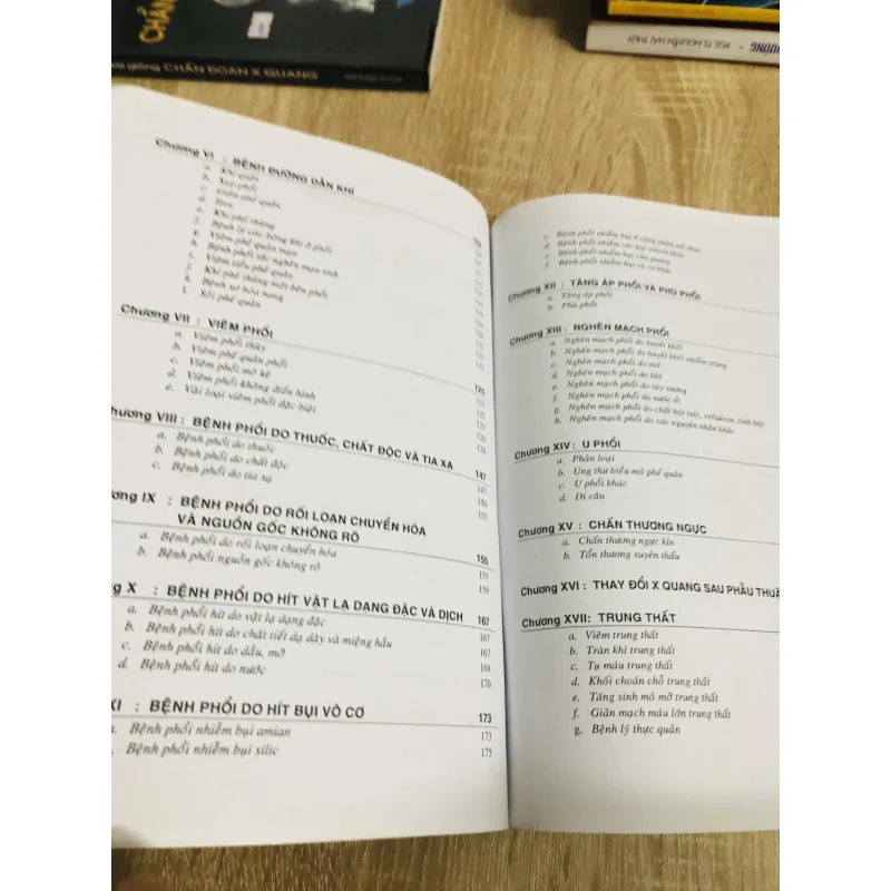 X QUANG NGỰC  1013044