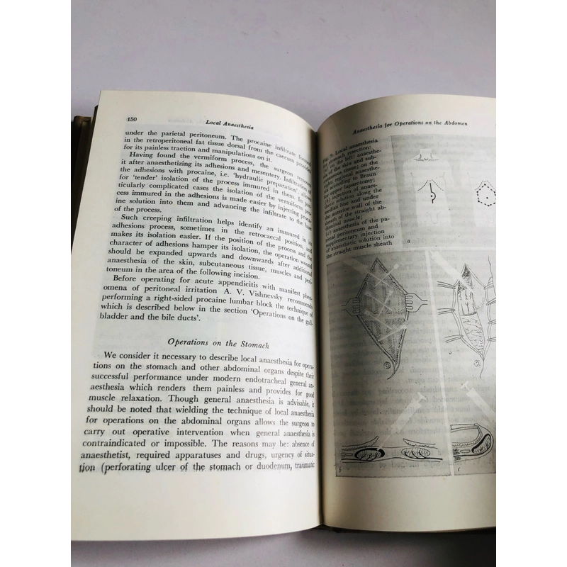 GÂY TÊ TẠI CHỖ  - sách bìa cứng, 226 trang, nxb: 1983 532323
