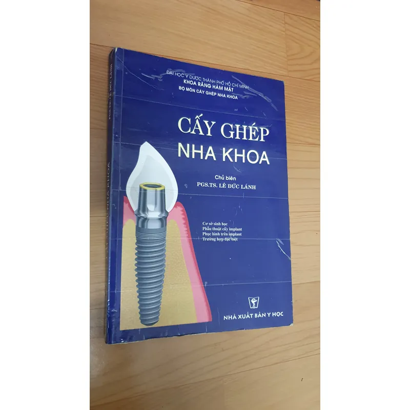 CẤY GHÉP NHA KHOA 740877