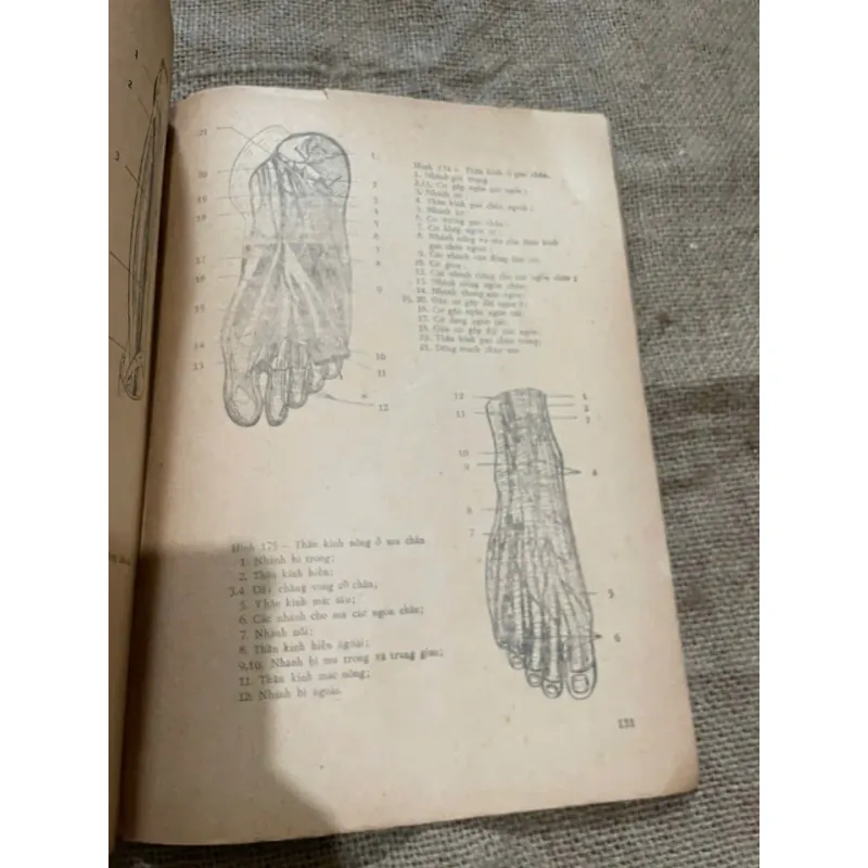 Chẩn đoán x quang lâm sàng BỘ XƯƠNG - BỘ TIẾT NIỆU - HỆ THẦN KINH - SÁCH Y, KHỔ LỚN 573048