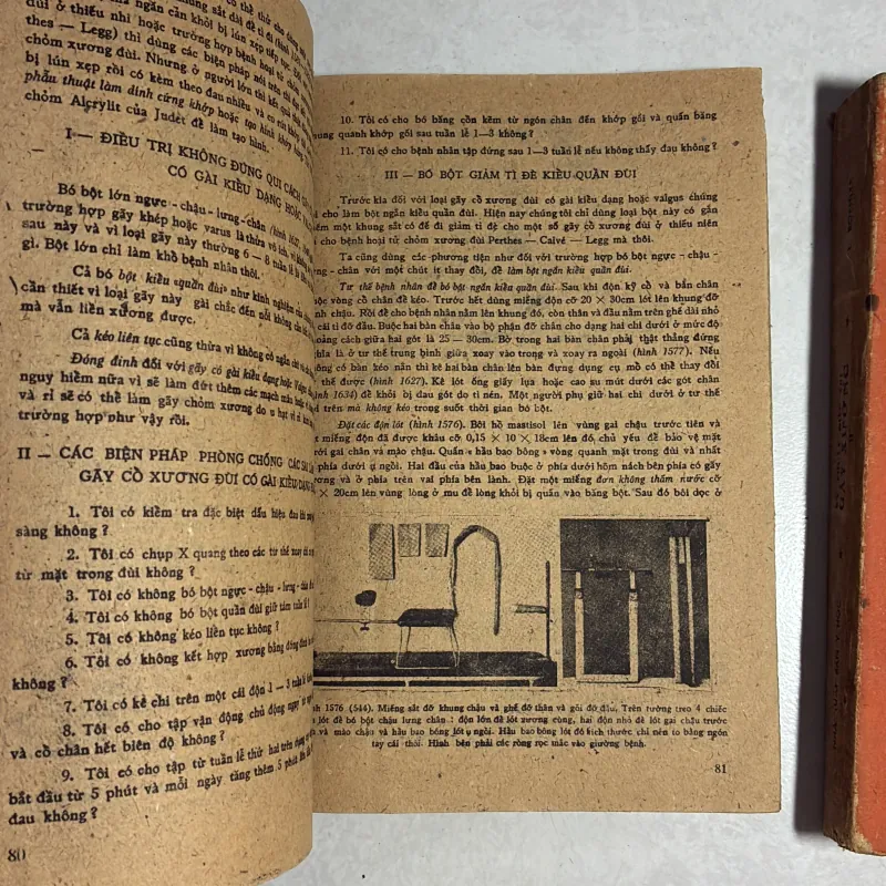Kỹ thuật điều trị gãy xương - L. Boehler - 1982s 786237