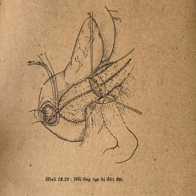 Bài giảng Điều trị học ngoại khoa, Trương Công Trung - Nguyễn Đình Hối 710862