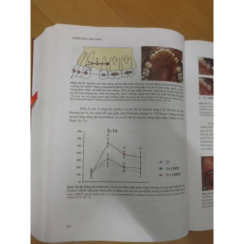 CHỈNH NHA LÂM SÀNG TẬP 1 689476