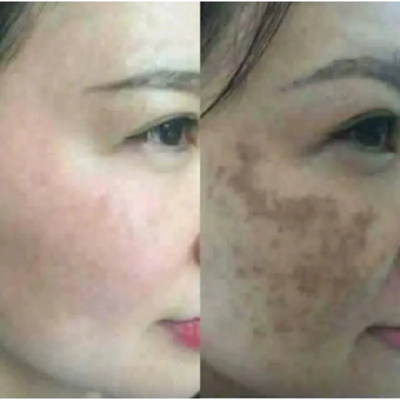 Kem trị nám, thâm xách tay Hàn Quốc 971583