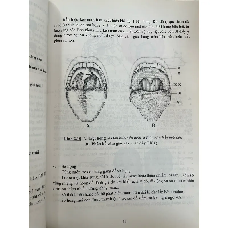 Viêm họng amidam và VA - PGS,TS. Nguyễn Hữu Khôi 719525
